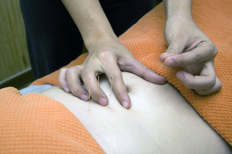 osteopathe-GASSIN-min_acupuncture-4175625